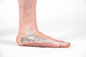 Exercises to Strengthen Flat Feet