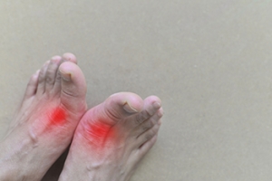 Understanding Gout