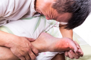 Managing Nighttime Gout Flares