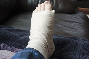Lisfranc Injuries